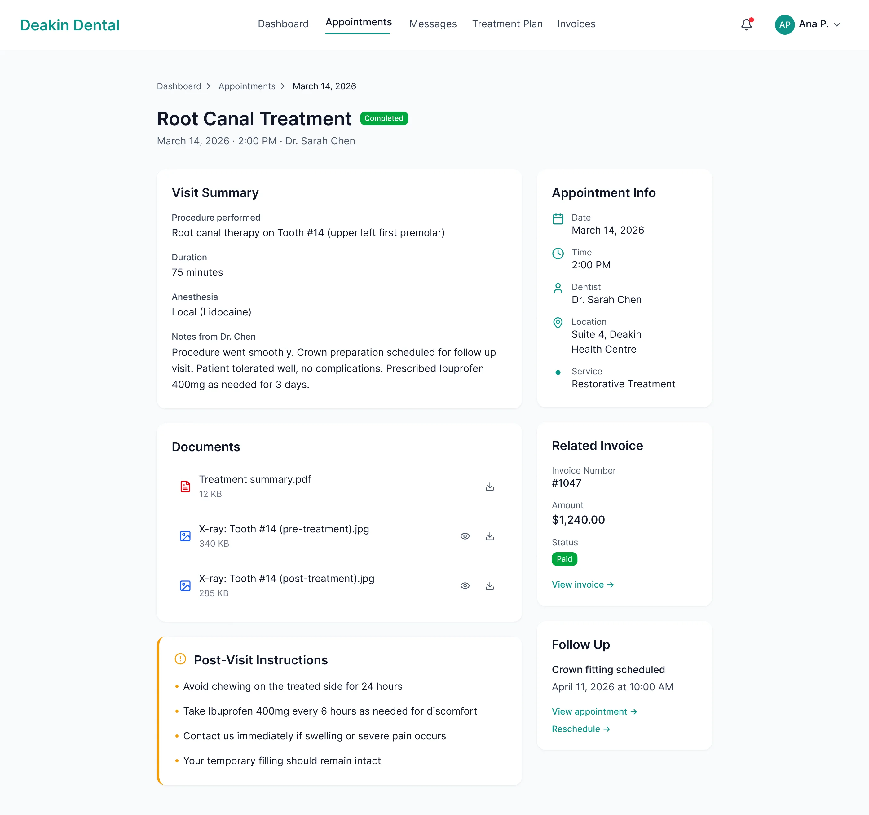 Deakin Dental appointment detail with visit summary, dentist notes, X rays and aftercare instructions